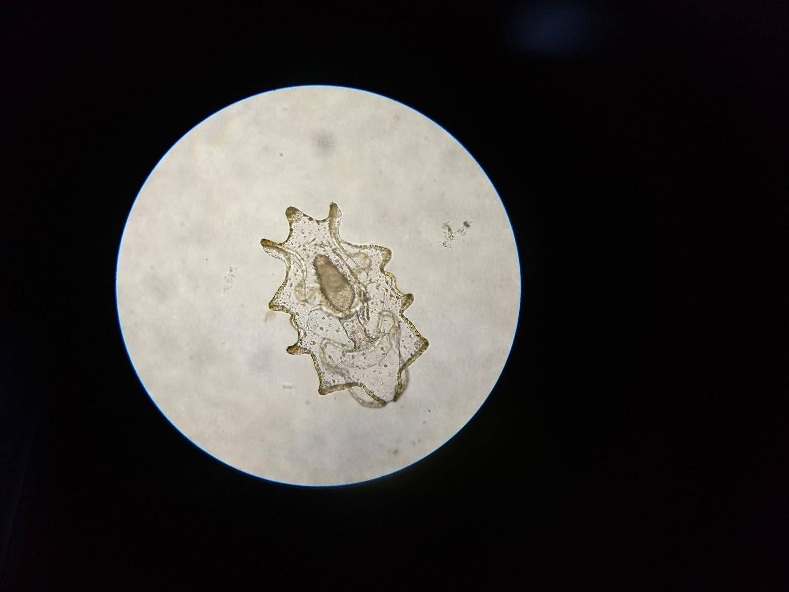 Auricularia, the planktonic larval stage of Holothuria scabra
